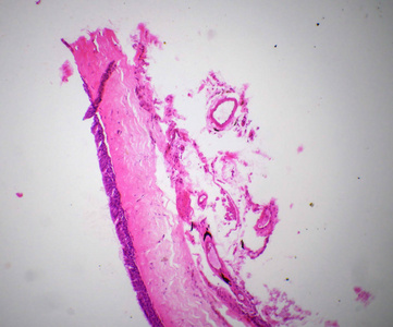 Ciliatde 上皮细胞在显微镜下一节