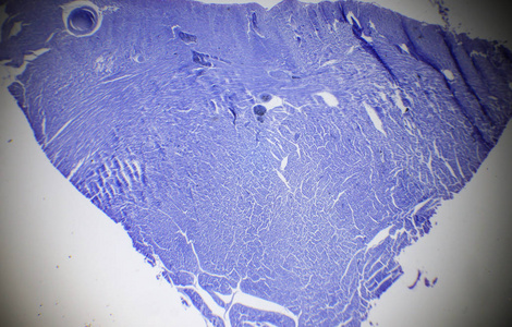 在显微镜下心脏肌肉部分