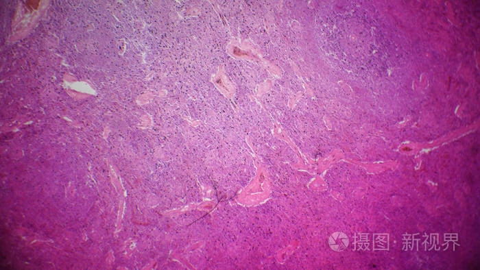 在显微镜下的胰腺部分