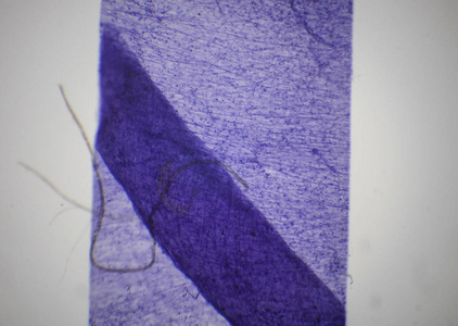 运动神经传导在显微镜下运动神经元照片