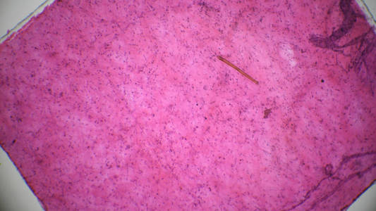 结蹄组织显微镜图片图片