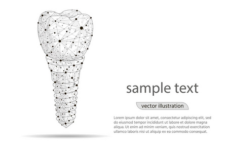 抽象设计牙种植体图标, 从低聚线框在白色背景隔离。矢量抽象多边形图像的混合线和点。数字图形