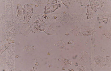 上皮组织与细菌细胞酵母细胞