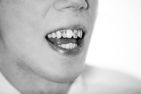 一个男人的嘴歪黄牙特写照片