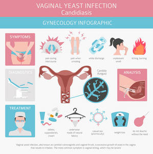 酵母感染。念珠菌病。Ginecological医疗疾病图表。矢量插图