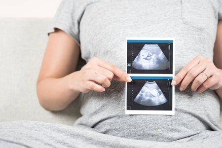 柔软的焦点和模糊的快乐怀孕妇女坐在沙发上, 在家里举行和显示超声波扫描她的婴儿照片给你。怀孕, 医疗, 父母和爱的概念与复制空间