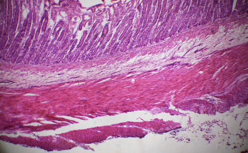 小肠横切显微镜图图片