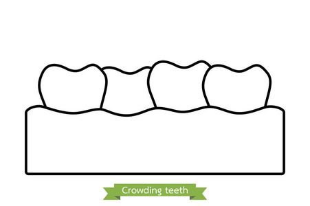 拥挤牙齿错 牙合卡通矢量轮廓样式