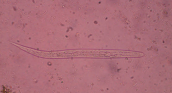 粪便中粪类圆线虫 (threadworm)照片