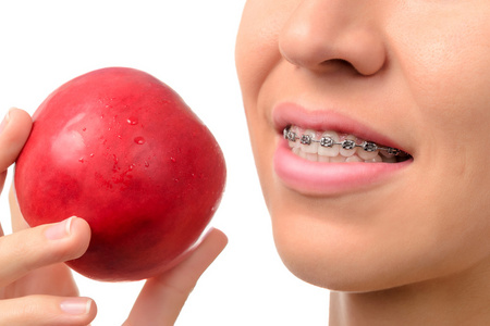 女性牙齿与牙齿矫正和红红的苹果
