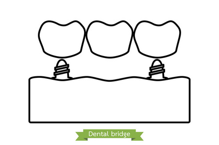 牙科桥卡通矢量轮廓样式