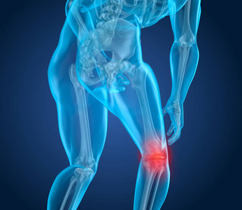 膝盖疼痛发作, 人患脊柱膝部。3d 插图