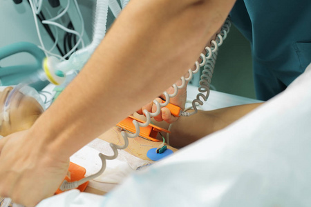 电休克 (除颤) 给病人照片