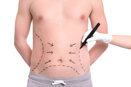 医生画线在人的胃与标记反对白色背景