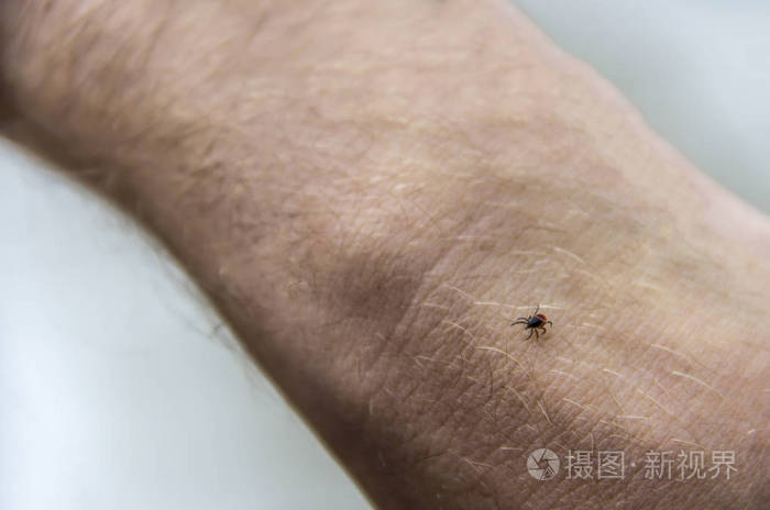在一个人的胳膊上的身体爬行一个红色蜱螨