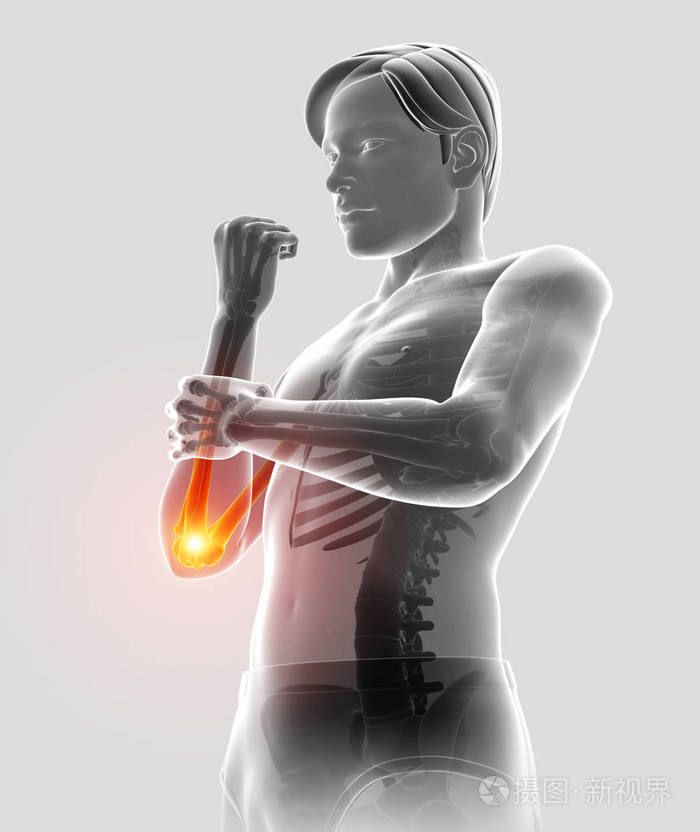 3d 插图男性感觉胳膊肘疼痛照片 正版商用图片0ovlbr 摄图新视界
