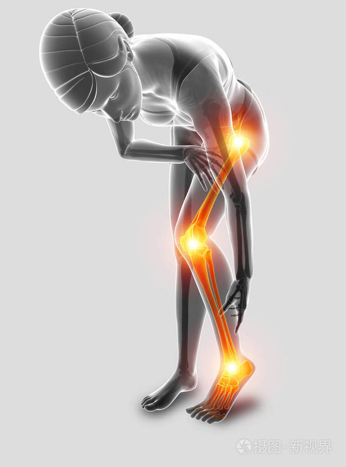 腿痛3d图