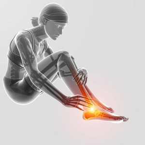 3d 插图的女性脚和踝关节疼痛