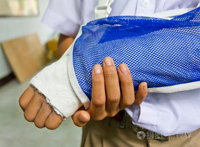 学生的胳膊断了