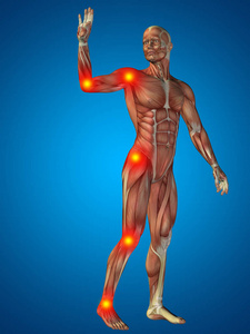 人体解剖学与痛苦迹象髋关节疼痛髋关节痛骨骼 x 射线,3d 图背痛.