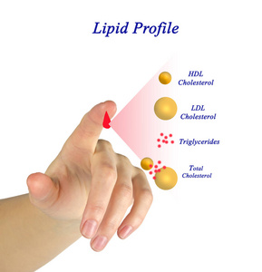 妇女呈现脂质概况