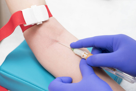 白人护士与蓝色乳胶 glowes 是采取血液分析或研究从病人静脉到 plastick 瓶针