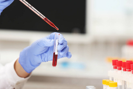 科学家使用血液样本
