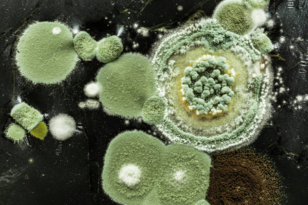 可能是由污垢病毒霉菌或细菌引起的.