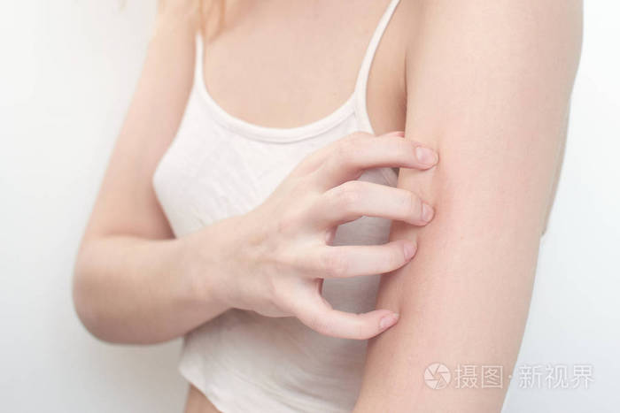 女人抓臂, 特写, 皮肤发痒的概念