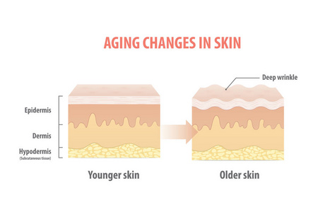 白色背景下皮肤插图矢量的老化变化。美容理念