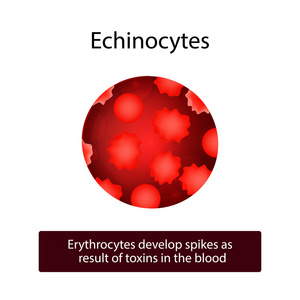 倒伏。红细胞发展由于血液中的毒素的穗状花序。对孤立背景矢量图