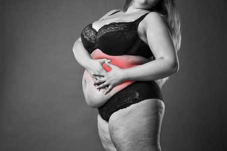 阑尾炎发作，腹痛，胃痛，超重女性的身体，在灰色的背景上的胖女人