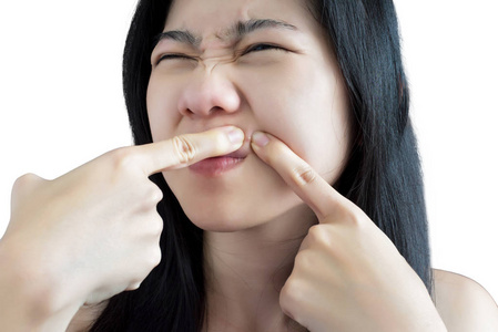 女人带走面具与痤疮和粉刺,白色背景亚洲女人试着挤鼻子痤疮粉刺女人