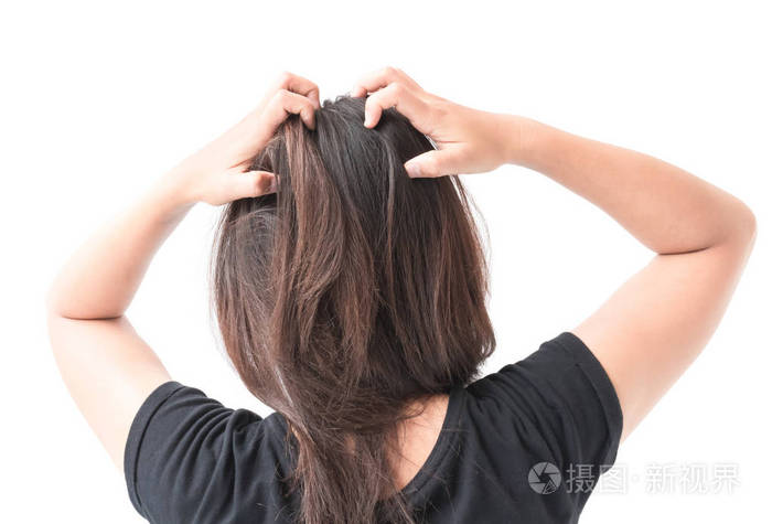 特写女人手发痒的头皮,头发护理概念