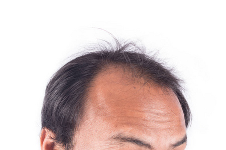 一个秃头男人的画像秃头的家伙,手在不同的方向和十三个年轻人秃头