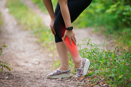 妇女胫骨疼痛, 女性腿部按摩, 跑步时受伤, 运动创伤, 户外概念
