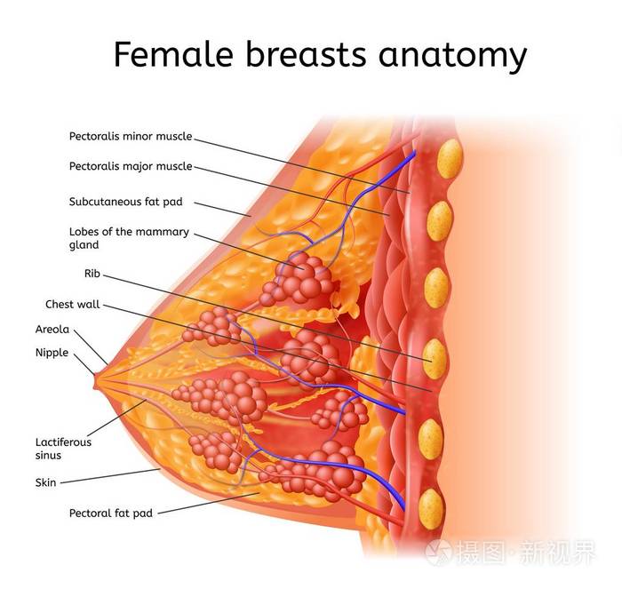 人乳腺癌解剖医学向量方案