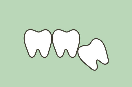 智齿 角或内侧撞击 对其他牙齿的影响牙科卡通矢量扁平式设计的可爱字符