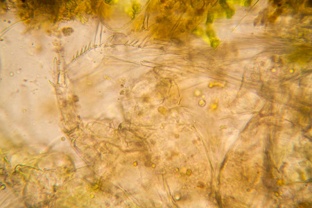 淡水池塘水浮游生物和藻类在显微镜下。死桡足类详细信息