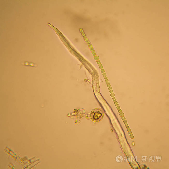 淡水池塘水浮游生物和藻类在显微镜下.念珠公社