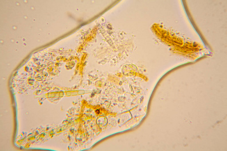 淡水池塘水浮游生物和藻类在显微镜下。硅藻