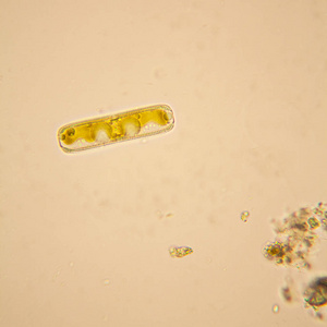 淡水池塘水浮游生物和藻类在显微镜下。硅藻