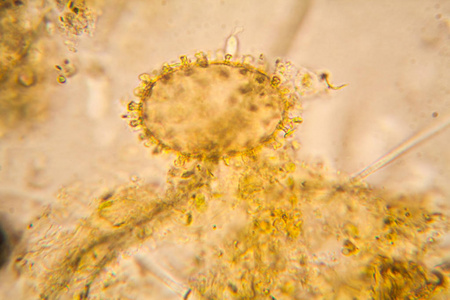 淡水池塘水浮游生物和海藻在显微镜下