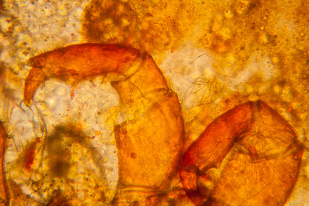 淡水池塘水浮游生物和藻类在显微镜下。池塘螨, 身体部分