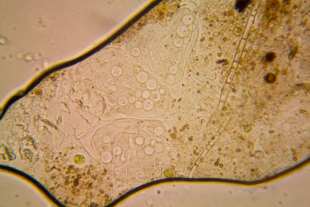 淡水池塘水浮游生物和藻类在显微镜下。Vorticella 找到