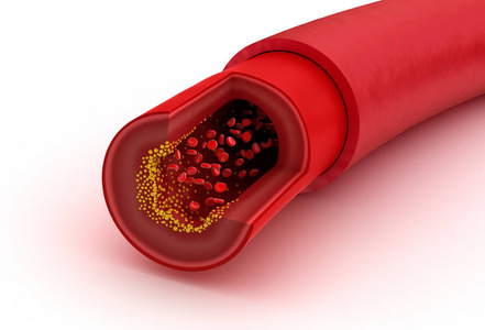 血管切片宏与红细胞,医学上准确的 3d 图照片