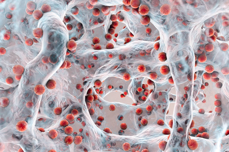 抗生素抗性生物被膜的耐抗生素细菌照片