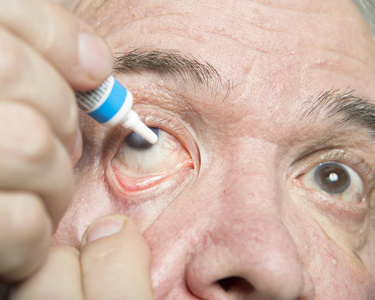 眼科疾病的诊治照片