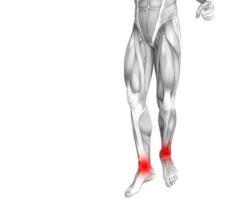 概念脚踝人体解剖学与红色热点炎症