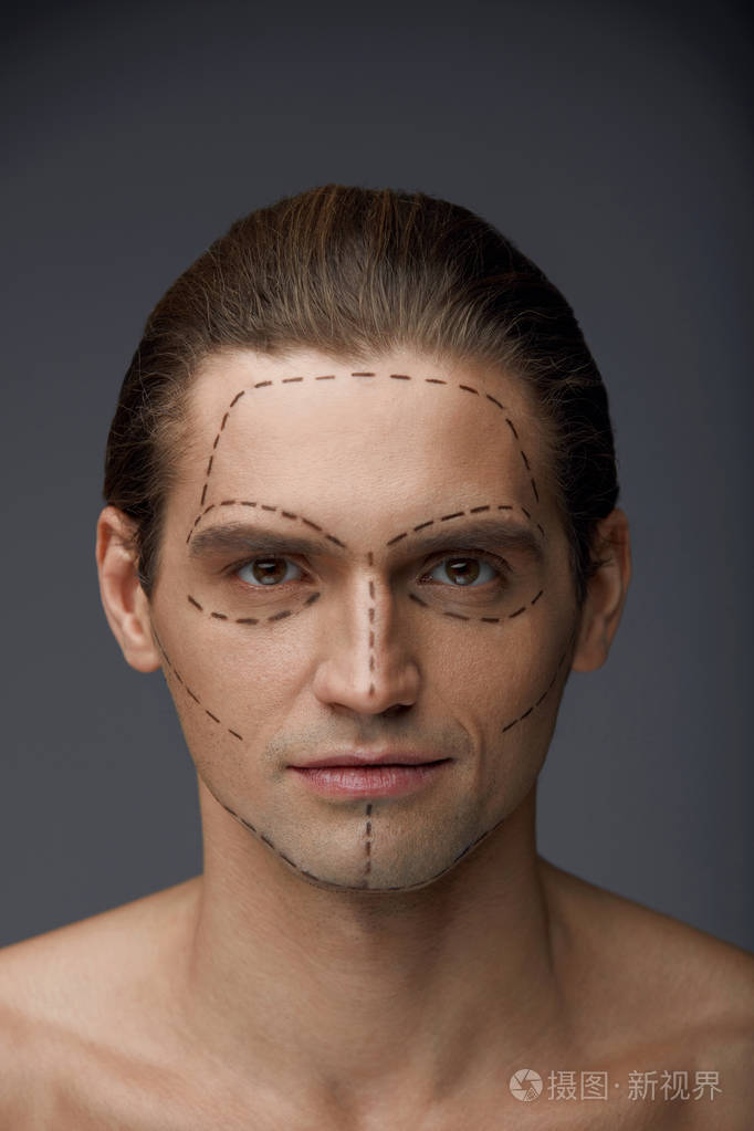 整形手术.英俊的男人,与面部皮肤上的线
